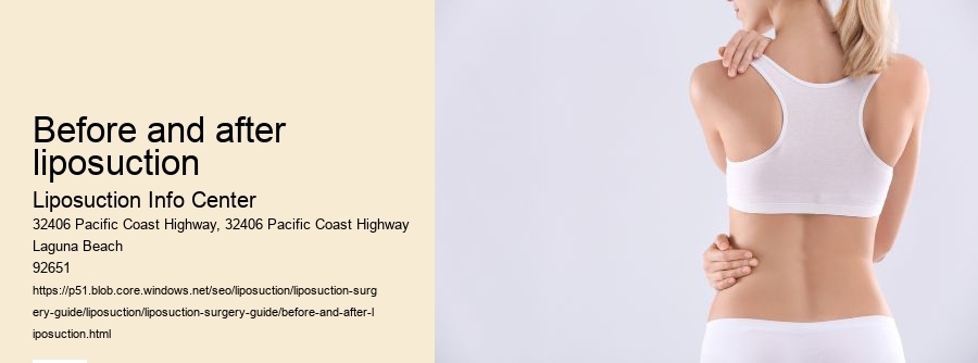 before and after liposuction