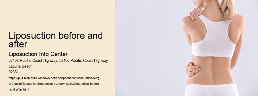 liposuction before and after